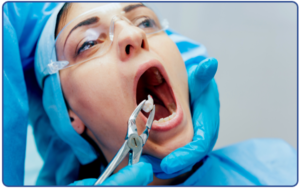 Wisdom Molar Extraction