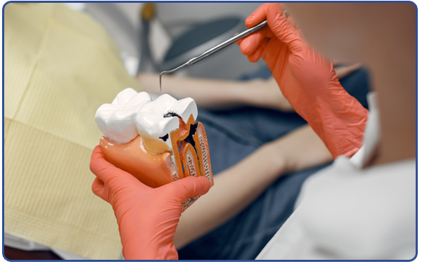 Root Canal Treatment