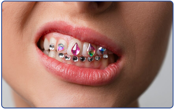 Tooth Jewellery